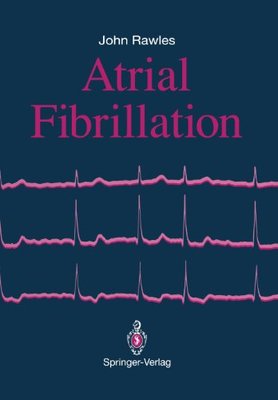 【预售】Atrial Fibrillation