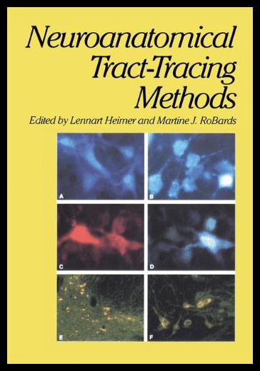 美国库房发货，通常付款后5-8周到货！