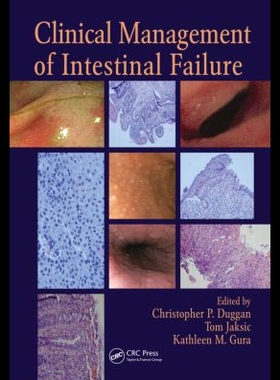 【预售】Clinical Management of Intestinal Fa...
