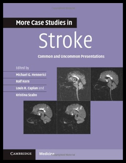 美国库房发货，通常付款后5-8周到货！