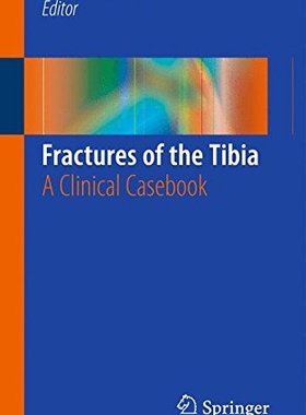 【预订】Fractures of the Tibia