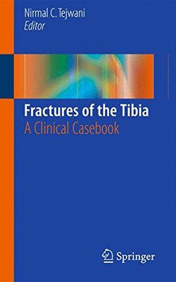 【预订】Fractures of the Tibia