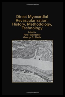 预售 History Direct Revascularization Met Myocardial