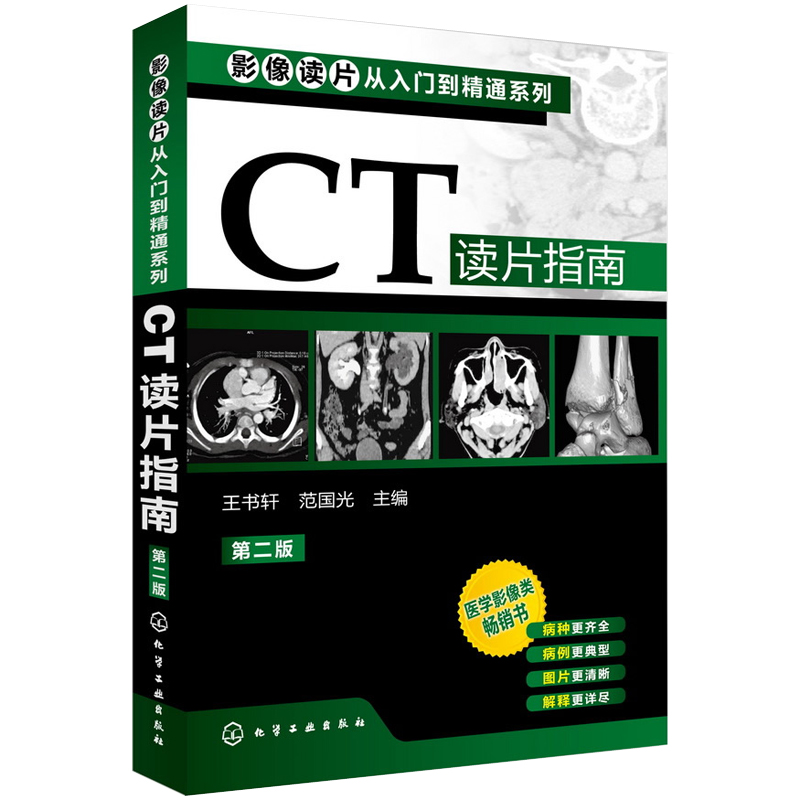 Õý°æ°üÓÊ ctÕï¶Ïѧ CT¶ÁƬָÄÏ-¶þ°æ Ó°Ïñ¶ÁƬ´ÓÈëÃŵ½¾«Í¨ÏµÁÐÓ°ÏñѧÕï¶ÏͼÆ×ҽѧӰÏñÕï¶Ïѧ¼¼Êõѧ ·ÅÉäҽѧͼÆ×Êé¼® Êé
