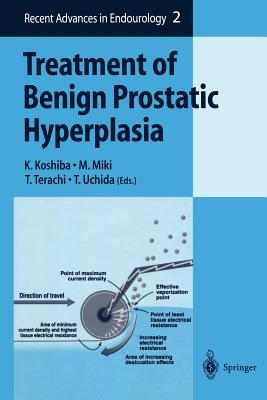 【预订】Treatment of Benign Prostatic Hyperplasia