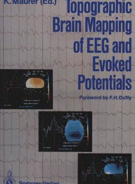 【预订】Topographic Brain Mapping of Eeg and...