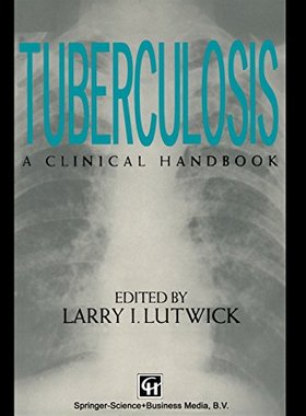 【预订】Tuberculosis