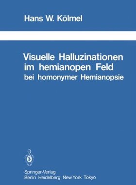 【预订】Visuelle Halluzinationen Im Hemianop...