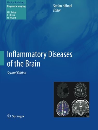 【预订】Inflammatory Diseases of the Brain