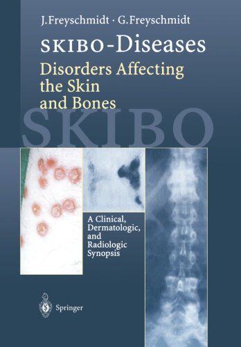 【预订】Skibo-Diseases Disorders Affecting t...