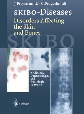 【预订】Skibo-Diseases Disorders Affecting t...