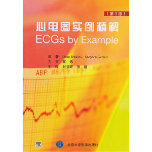 心电图实例精解（E)