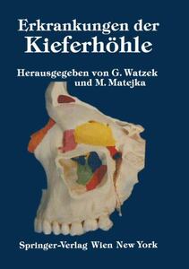 【预订】Erkrankungen Der Kieferhohle: Sympos...