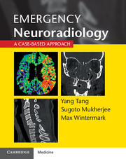 【预订】Emergency Neuroradiology