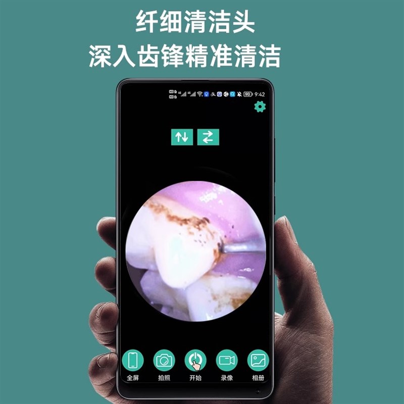 月儿弯弯超声波洗牙器牙结石去除器洁牙仪电动清洁牙齿牙石牙垢
