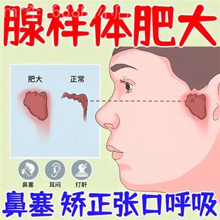 速发腺样体肥大调理儿童宝宝面容矫正器不通气中药贴嘴贴鼻塞张嘴