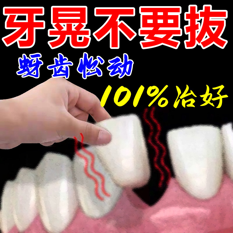 工厂销牙松不用拔牙疼牙齿松动药A牙龈肿痛萎缩牙疼牙晃动固齿专