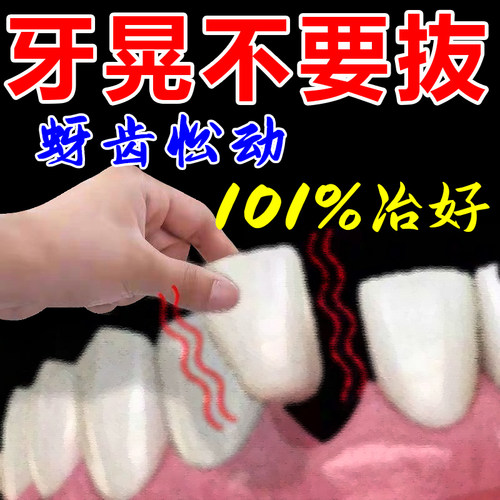 工厂销牙松不用拔牙疼牙齿松动药A牙龈肿痛萎缩牙疼牙晃动固齿专