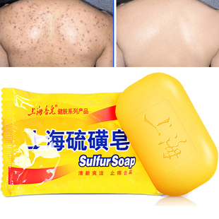 Oil 身体磨砂膏soap Sulfur 极速85g Soap Acne Shanghai Control