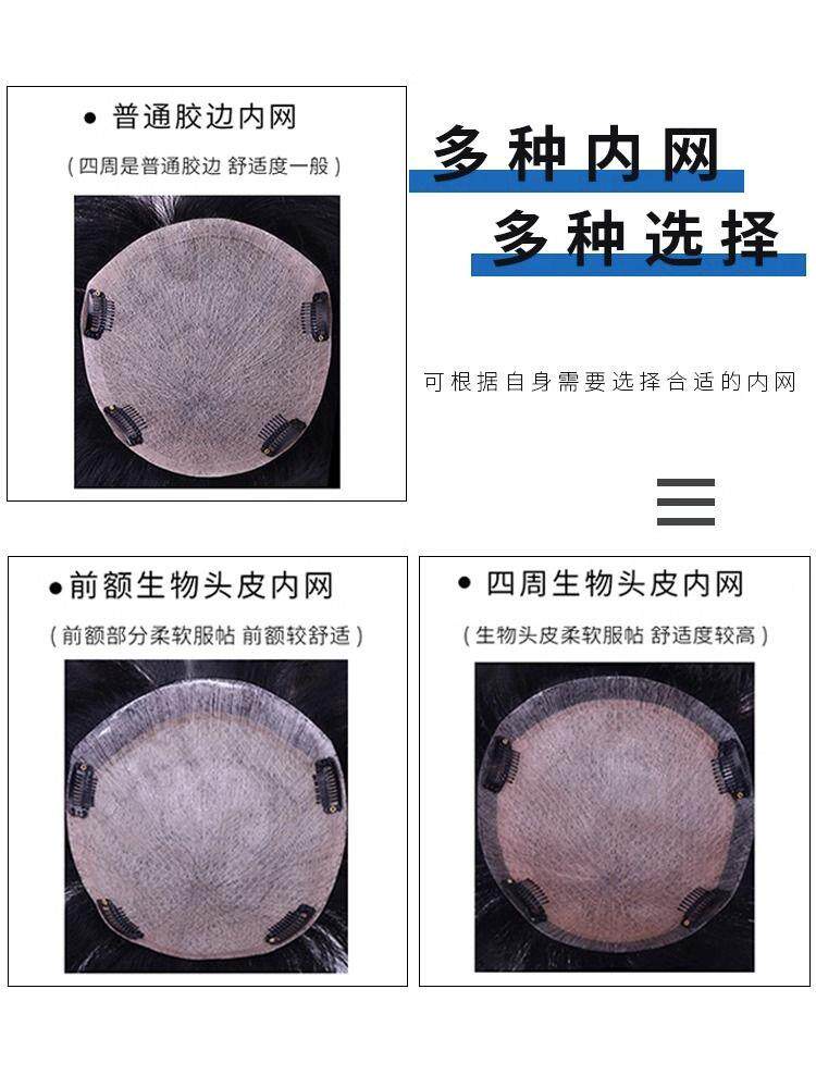 假发男短发隐形ZYG自然头顶补发真片时尚帅气三七S分额型M前发际
