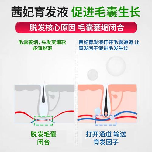 脂溢/熬夜/压力型脱发/育发液头发增密快速增长多男女生防脱神器