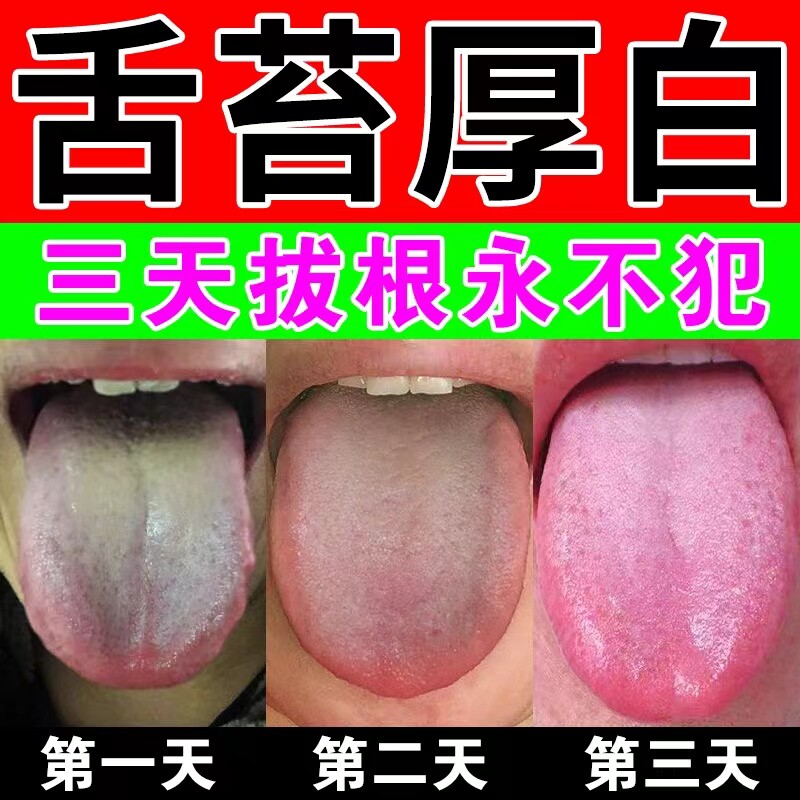 100%根】舌苔厚白厚黄腻调理脾胃除口臭口苦口干去湿气特效喷