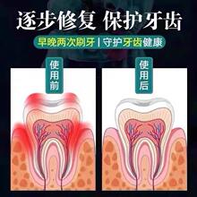 牙齿晃动 t修牙复龈委缩牙齿松动出血肿痛固齿专用牙 101%扎根