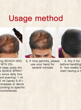 30ml Hair Natural Faster Growing Spray Hair Loss treatment