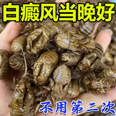 推荐【一个老方】白癜风外用药膏皮肤白斑色素快速消白斑专用药膏