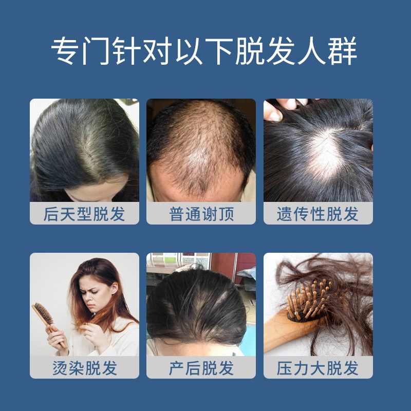 南方医学研究院快速生发剂防脱育发液秃顶斑秃增发密发发际线增长