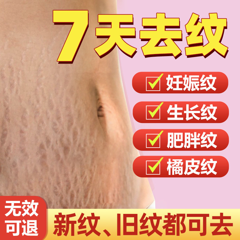 祛除妊娠纹产后修复霜去消肥胖纹妊辰生长纹淡化紧致孕妇专用预防