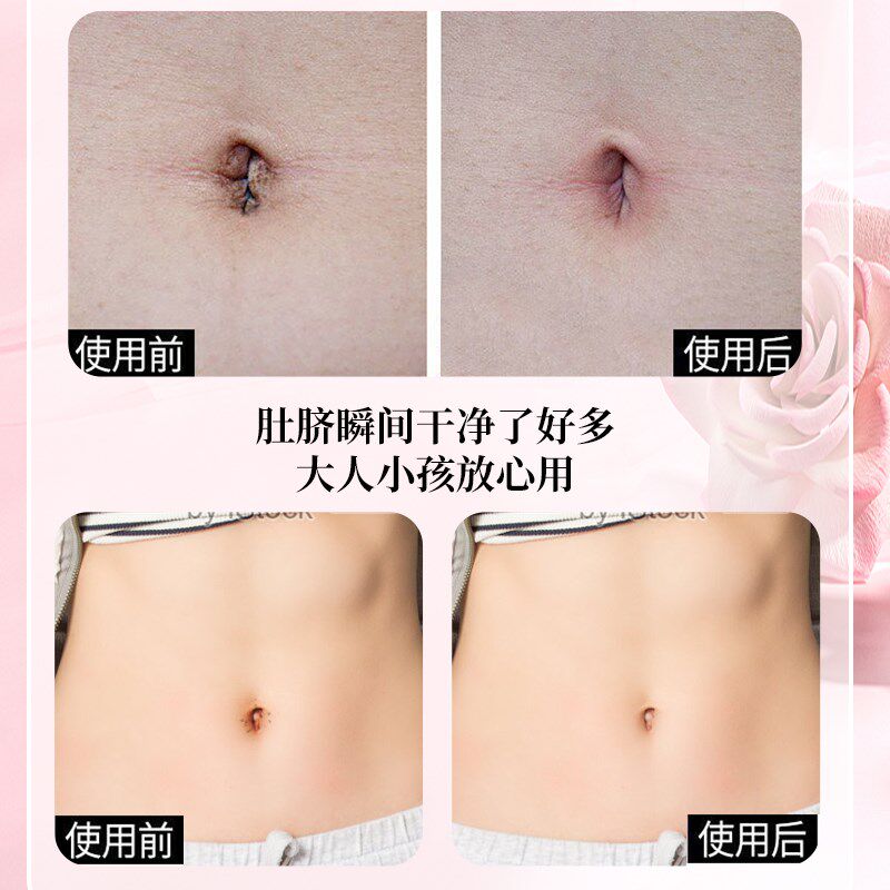 洗肚脐眼神器清洁软化污垢精华清理除臭成人婴儿孕妇发炎出水修护