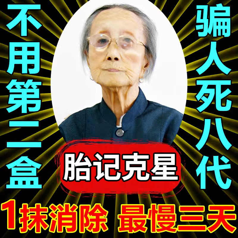 速发胎记去除神器去黑色素沉淀脸部淡化咖啡斑遮天生胎记膏太田痣