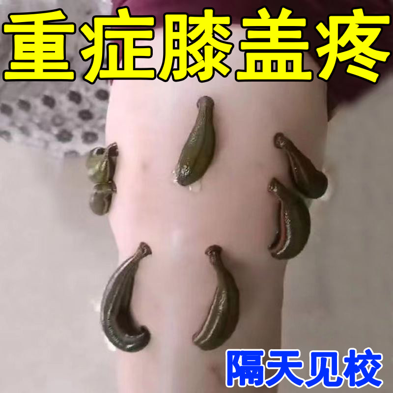 热销专冶膝盖疼【当晚消痛】膝盖关节疼痛半月板损伤修复滑膜积液