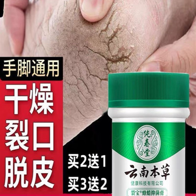 脚后跟开裂药膏手脚干裂脱皮真菌感染专用治脚底干燥皲裂修复药膏
