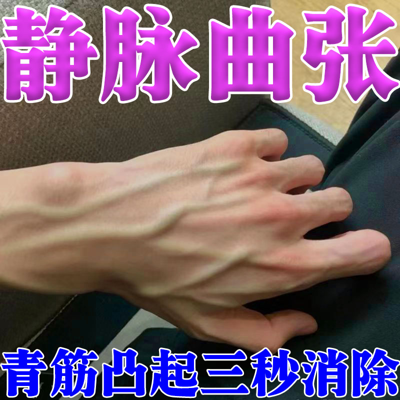 热销静脉曲张特效膏手背青筋凸起红血丝疏通静脉缓解曲张专用冷敷