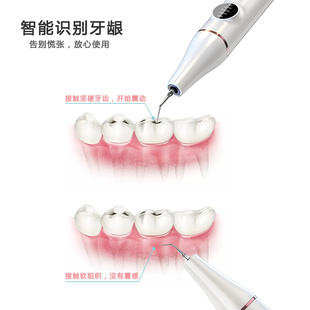 现货速发真超声波洗牙器家用牙齿污垢溶解机清理洁牙仪电动牙结石