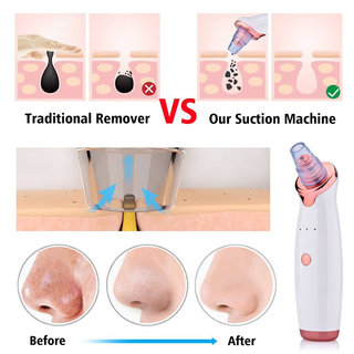 推荐Vacuum Blackhead Remover Face Black Spots Cleaner White