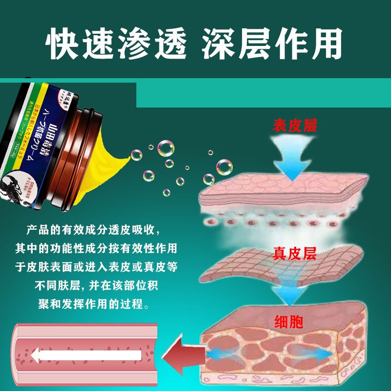新品治紫癜专用膏皮下出血色素沉着红点瘀滞过敏性紫癜皮炎血管性