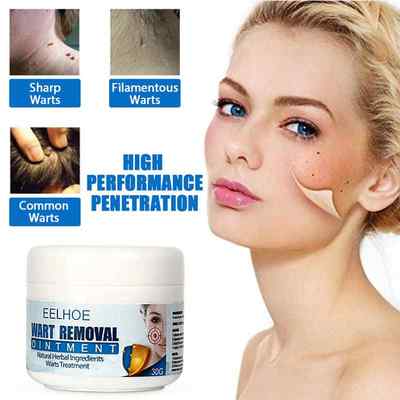 新品30g Skin Tag Remover Cream Warts Mole Remove Ointment An