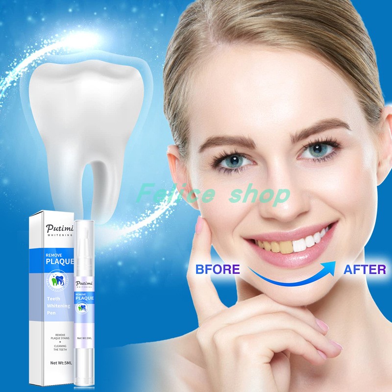 速发Teeth Whitening Pen Tooth Gel Whitener Bleach Remove Sta