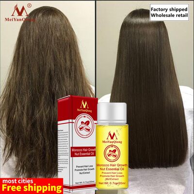 推荐Fast strong hair growth essence improves frizz Essential