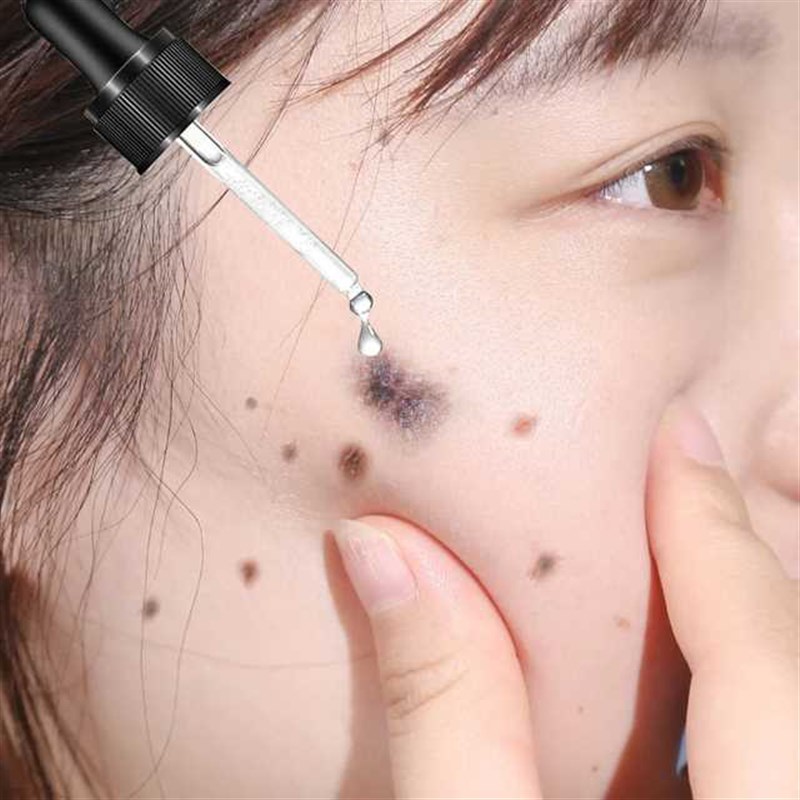 速发模特都在偷偷用~去脸上一切黑点 斑点 不留痕不结痂 买2送1