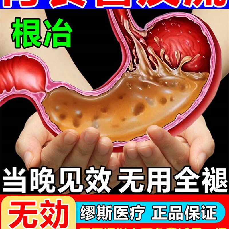 新品苗昶堂胃食管反流贴治胃反酸烧心反流性食管炎中医专用贴反流