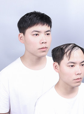 男士假发中年男人前额头寸头真发短发全头套韩版帅气头顶发际线贴