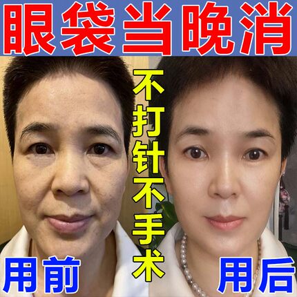 眼袋去除神器男士女克星消眼膜祛眼袋治贴膜淡化黑眼圈专用眼霜