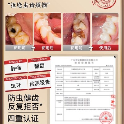 推荐牙疼牙痛止疼药速效喷剂宁杀牙神经智齿牙龈肿蛀牙虫牙拔牙专