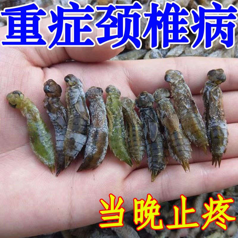 推荐【300%管用】重度颈椎病颈椎酸痛颈椎压迫脖子僵硬富贵包专用