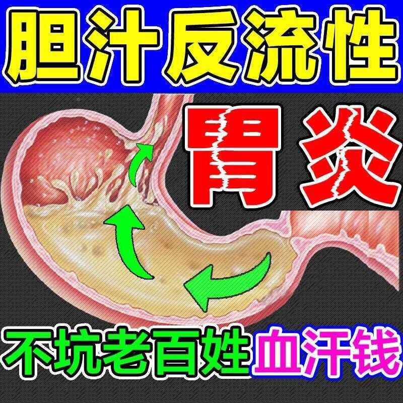 速发胃食管反流i贴反流性食道炎胃反酸烧心胃灼热胸痛吐胆汁调理