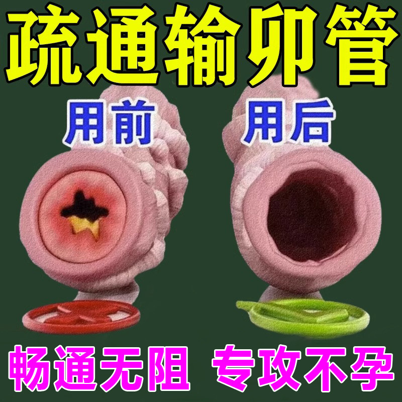 热销疏通卵管不通热敷包通而不畅宫腔盆腔输积水积液黏连堵塞备孕